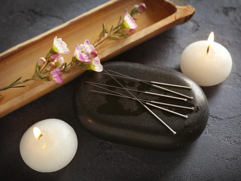 Dealta_Alt_Med_Acupuncture